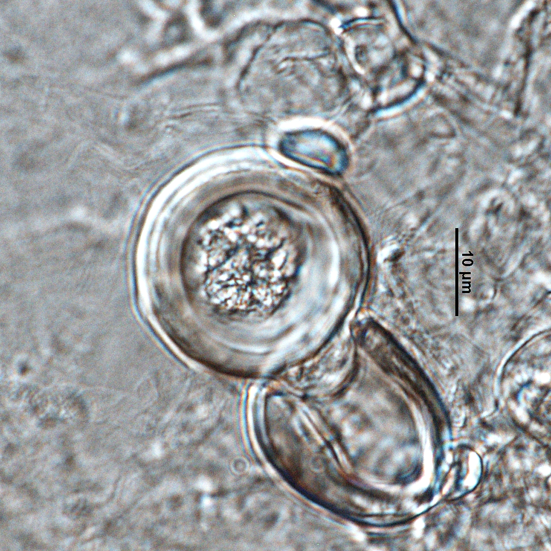   Phytophthora ramorumnbsp; (ex-type CPHST BL 55G)nbsp;sexual phase: plerotic oospore of ex-type (A1, EU1) produced with tester strainnbsp; P. capsicinbsp; (A2, ex-type CPHST BL 33); photo by Gloria Abad, USDA-APHIS-PPQ. 
